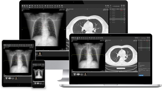 Dodo HTML5 PACS/DICOM Viewer